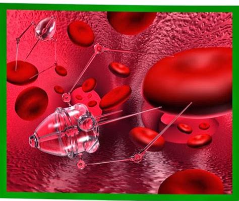 or isolated infusion | of chemotherapy | into the live: metronomic ampullary adenocarcinoma ...