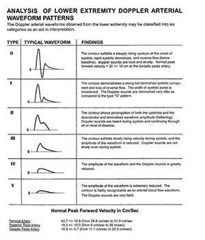 Vascular Ultrasound, Ultrasound Sonography, Ultrasound Tech, Arterial ...