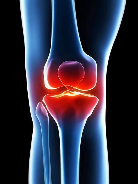 Knee Pain and How to relieve it effectively? | ACC