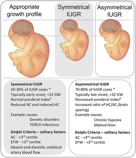 Intrauterine growth restriction, causes, symptoms, diagnosis, treatment ...