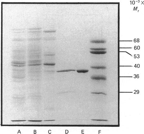 Purification of chorismate synthase from E. coli strain AB2849/pGM602 ...