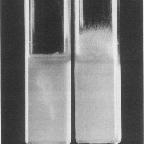 Cylindrical columella with collar (top) and conical columella (bottom).... | Download Scientific ...