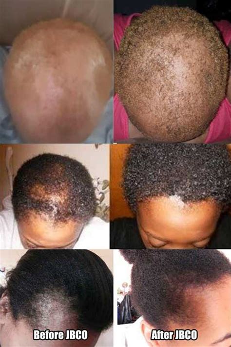 Jamaican Black Castor Oil Hair Growth, How to use, Reviews, Challenge, Results, Where to Buy ...