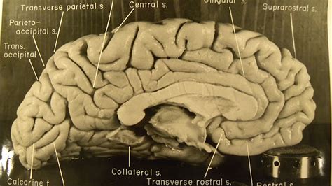 Albert Einsteins Brain Compared Average Brain