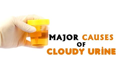 8 Major Causes of Cloudy Urine - YouTube