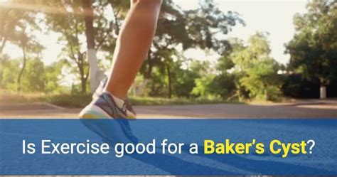 Is Exercise good for a Baker’s Cyst? - OSMO Patch US