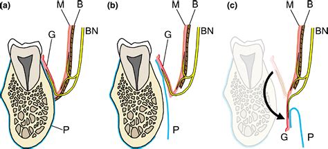 The course and distribution of the buccal nerve: clinical relevance in dentistry - Takezawa ...