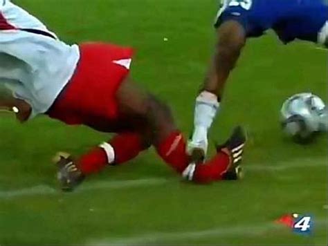 Worst Soccer Injuries (15 pics)