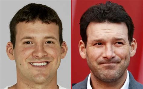 Tony Romo Plastic Surgery: Unravelling the Former NFL Star’s ...