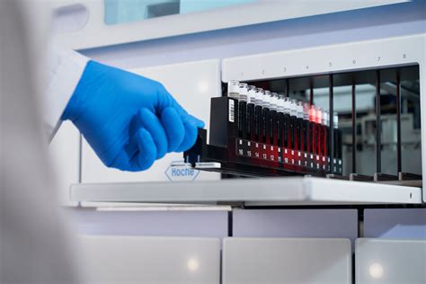 Roche launches cobas® 5800, a new molecular diagnostics system to expand access to testing and ...