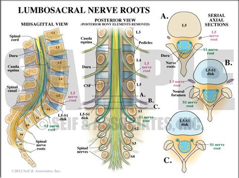 Case Study: Lumbar Nerve Root Compression | Nerve anatomy, Spine surgery, Spinal surgery