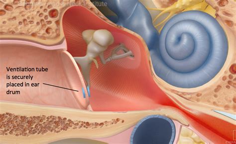 Ear Infections Treatment Los Angeles, CA