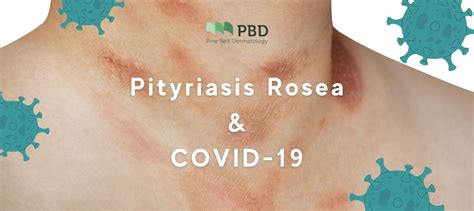 Pityriasis Rosea & It's Connection To COVID-19|Pine Belt Derm, MS