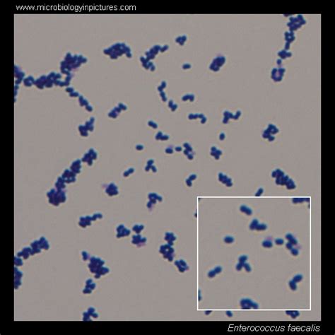 Enterococcus microscopy. Enterococcus Gram-stain and cell morphology ...