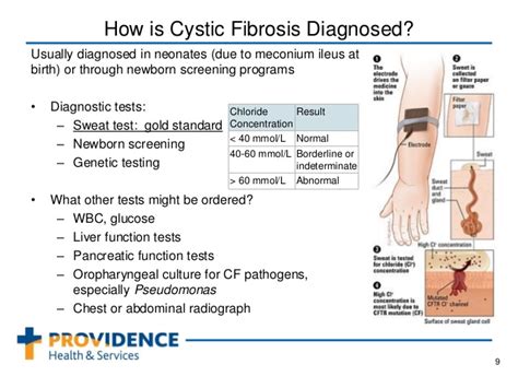 Sweat Test for Cystic Fibrosis - The Secret Knowledge About Health