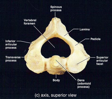 Views of Vertebrae