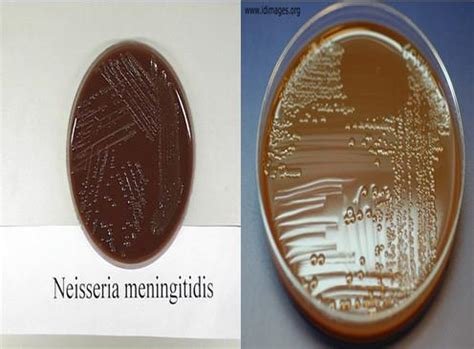 Neisseria meningitidis | Medical Laboratories