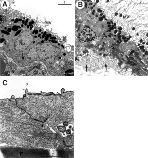 Differences in the shape of RPE-J, P2 RPE, and adult RPE cells. P2 (A),... | Download Scientific ...