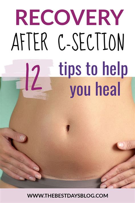 How to Heal from an Unexpected C-Section | C section, C section recovery, C section belly