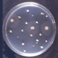 Observing bacteria | Bacteria | Microbiology Society