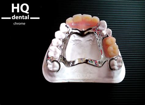 A chrome framework connects onto and around existing teeth to hold the ...