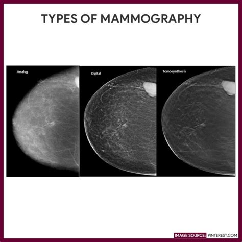 Mammography (Mammogram) - Nursing Responsibilities - Nurseslabs