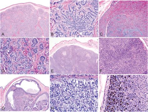 Histologic features of hair follicle neoplasms and cysts in dogs and ...