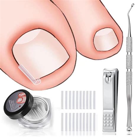 6X Ingrown Toenail Set Tools Kit Nail Treatment Foot Hands, 52% OFF