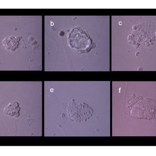 Evolution of experimental blastomere growth observed on feeder cell... | Download Scientific Diagram