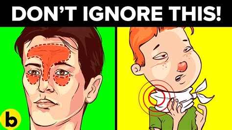13 Sinus Infection Symptoms That You Should Not Ignore - YouTube