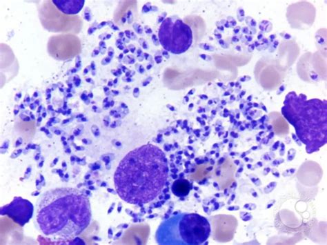 Giemsa Stain: Principle, Procedure, Results • Microbe Online