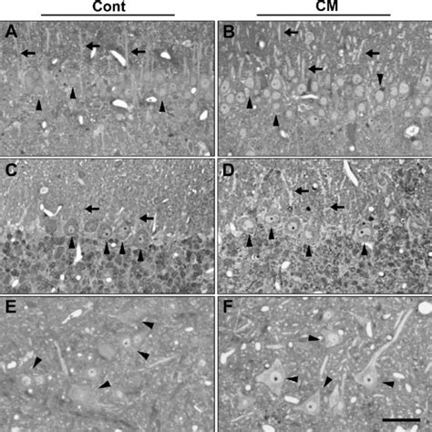 Light microscopic images of hippocampus CA1 pyramidal cells (A, B ...