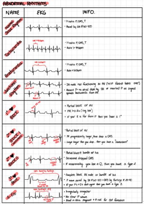 Ekg - Bosyap Blog in 2020 | Medical surgical nursing, Ecg rhythms, Nursing school notes