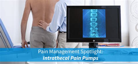 Pain Management Spotlight: Intrathecal Pain Pumps | NJSO