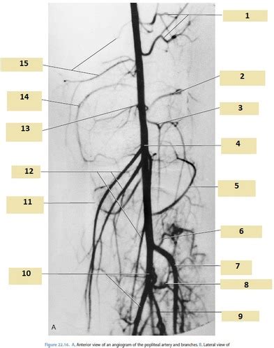 L Popliteal Artery Anatomy Flashcards | Quizlet