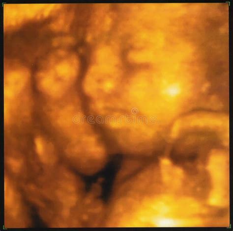 Three-dimensional sonogram stock photo. Image of profile - 1257086