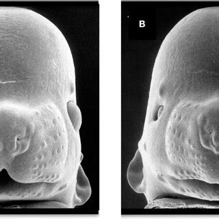 Facial dysmorphology induced by prenatal ethanol exposure.... | Download Scientific Diagram