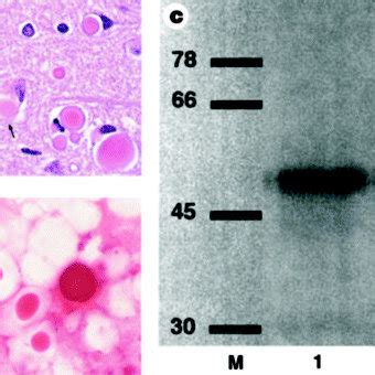 Identification, purification and composition of Collins bodies.a,... | Download Scientific Diagram