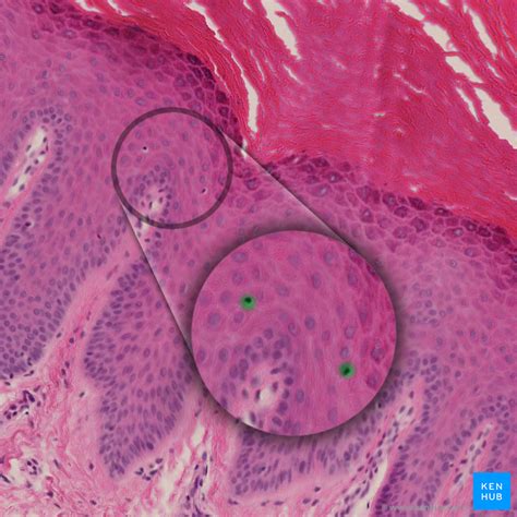 Skin - Cells, Layers & Histological Features | Kenhub