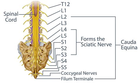 Radiculopathy Pinched Nerve Treatments in Miami | MNC