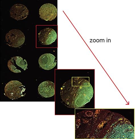 Tissue MicroArrays - Innopsys