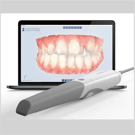 How An Intra-oral Scanner works? ~ Dr. Bharat Katarmal Dental & Implant Clinic