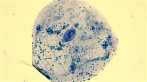 Micrograph human cheek epithelial cells methylene blue 1000X p000018 | OER Commons