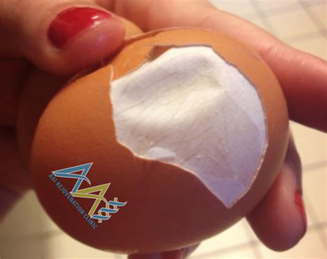 Natural Eggshell Membrane (NEM) - Rebuild Cartilage | AAI Clinic