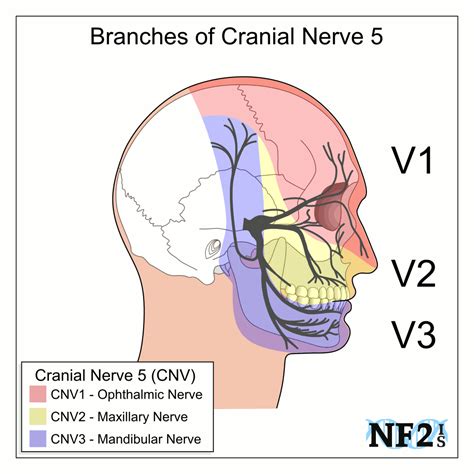 Cranial Nerve 5, CN5, Ophthalmic Nerve, V1, CNV1, CN51, Maxillary Nerve, V2, CNV2, CN52 ...