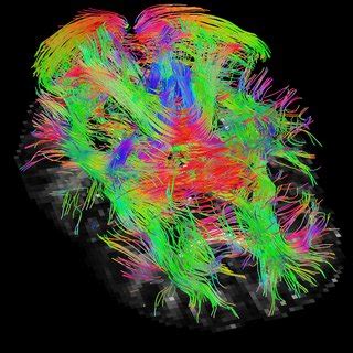 Tractography visualization results on the in vivo brain data. (a ...