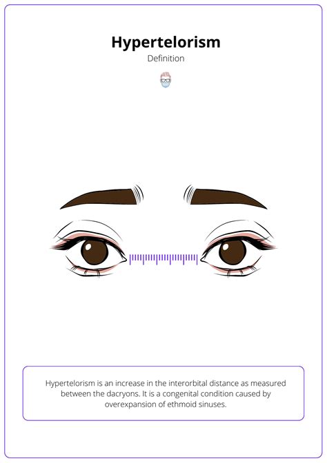 Hypertelorism: Definition, Classifying, Causes, & Treatment