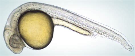 Research on Amino Acids Provides Insight Into Human Embryo Development, Defects