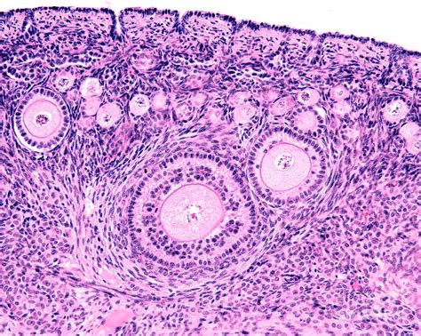 Ovarian Follicles #3 Photograph by Jose Calvo/science Photo Library ...