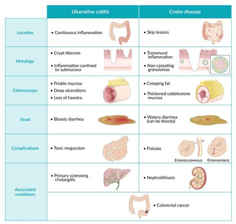 Season Star Circle crohns disease blood in stool boiler Go to the circuit Nutrition